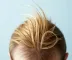 Quantos fios de cabelo crescem por dia e quanto cresce?